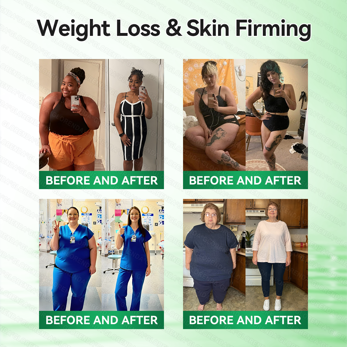 𝑶𝒇𝒇𝒊𝒄𝒊𝒂𝒍 𝑺𝒕𝒐𝒓𝒆  | 💯💯𝐂𝐚𝐫𝐞𝐔𝐩𝐥𝐢𝐟𝐭®𝑴𝒐𝒓𝒊𝒏𝒈𝗮 · 𝗕𝗲𝗿𝗯𝗲𝗿𝙞𝙣𝙚 × 𝙉𝘼𝐃+ 𝟏𝟎-𝐢𝐧-𝟏 𝗔𝗱𝘃𝗮𝗻𝗰𝙚𝙙 𝙉𝙖𝙣𝙤 𝙈𝙞𝙘𝙧𝙤𝙣𝙚𝙚𝐝𝐥𝐞 𝐏𝐚𝐭𝙘𝙝🇺🇸(𝐉𝐮𝐬𝐭 𝐨𝐧𝐜𝐞 𝐚 𝐝𝐚𝐲, 𝐯𝐢𝐬𝐢𝐛𝐥𝐞 𝐜𝐡𝐚𝐧𝐠𝐞𝐬 𝐢𝐧 𝟕 𝐝𝐚𝐲𝐬） ✅ 𝐅𝐨𝐫 𝐨𝐛𝐞𝐬𝐢𝐭𝐲, 🅛🅞🅞🅢🅔 🅢🅚🅘🅝,𝐝𝐢𝐚𝐛𝐞𝐭𝐞𝐬, 𝐬𝐥𝐞𝐞𝐩 𝐚𝐩𝐧𝐞𝐚, 𝐣𝐨𝐢𝐧𝐭 𝐢𝐬𝐬𝐮𝐞𝐬, 𝐚𝐧𝐝 𝐦𝐨𝐫𝐞💯