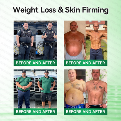 𝑶𝒇𝒇𝒊𝒄𝒊𝒂𝒍 𝑺𝒕𝒐𝒓𝒆  | 💯💯𝐂𝐚𝐫𝐞𝐔𝐩𝐥𝐢𝐟𝐭®𝑴𝒐𝒓𝒊𝒏𝒈𝗮 · 𝗕𝗲𝗿𝗯𝗲𝗿𝙞𝙣𝙚 × 𝙉𝘼𝐃+ 𝟏𝟎-𝐢𝐧-𝟏 𝗔𝗱𝘃𝗮𝗻𝗰𝙚𝙙 𝙉𝙖𝙣𝙤 𝙈𝙞𝙘𝙧𝙤𝙣𝙚𝙚𝐝𝐥𝐞 𝐏𝐚𝐭𝙘𝙝🇺🇸(𝐉𝐮𝐬𝐭 𝐨𝐧𝐜𝐞 𝐚 𝐝𝐚𝐲, 𝐯𝐢𝐬𝐢𝐛𝐥𝐞 𝐜𝐡𝐚𝐧𝐠𝐞𝐬 𝐢𝐧 𝟕 𝐝𝐚𝐲𝐬） ✅ 𝐅𝐨𝐫 𝐨𝐛𝐞𝐬𝐢𝐭𝐲, 🅛🅞🅞🅢🅔 🅢🅚🅘🅝,𝐝𝐢𝐚𝐛𝐞𝐭𝐞𝐬, 𝐬𝐥𝐞𝐞𝐩 𝐚𝐩𝐧𝐞𝐚, 𝐣𝐨𝐢𝐧𝐭 𝐢𝐬𝐬𝐮𝐞𝐬, 𝐚𝐧𝐝 𝐦𝐨𝐫𝐞💯