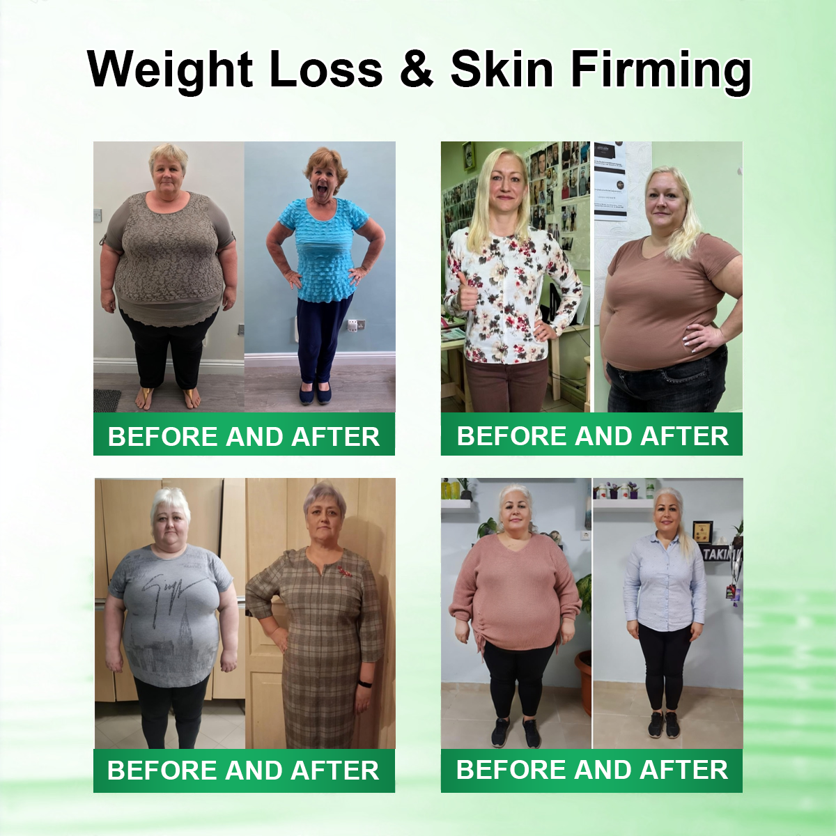 𝑶𝒇𝒇𝒊𝒄𝒊𝒂𝒍 𝑺𝒕𝒐𝒓𝒆 |🍀🍀𝐂𝐚𝐫𝐞𝐔𝐩𝐥𝐢𝐟𝐭® 𝑴𝒆𝒕𝒂𝒃𝒐𝒍𝒊𝒄 𝑵𝒂𝒏𝒐 𝑴𝒊𝒄𝒓𝒐𝒏𝒆𝒆𝒅𝒍𝒆 𝑷𝒂𝒕𝒄𝒉🇺🇸(𝐉𝐮𝐬𝐭 𝐨𝐧𝐜𝐞 𝐚 𝐝𝐚𝐲）𝘽𝙚𝙧𝙗𝙚𝙧𝙞𝙣𝙚 + 𝙈𝙤𝙧𝙞𝙣𝙜𝙖 𝙁𝙤𝙧𝙢𝙪𝙡𝙖 ✅𝐨𝐛𝐞𝐬𝐢𝐭𝐲,𝐅𝐨𝐫 𝗟𝗼𝗼𝘀𝗲 𝘀𝗸𝗶𝗻,  𝐝𝐢𝐚𝐛𝐞𝐭𝐞𝐬, 𝐬𝐥𝐞𝐞𝐩 𝐚𝐩𝐧𝐞𝐚, 𝐣𝐨𝐢𝐧𝐭 𝐢𝐬𝐬𝐮𝐞𝐬, 𝐚𝐧𝐝 𝐦𝐨𝐫𝐞💯