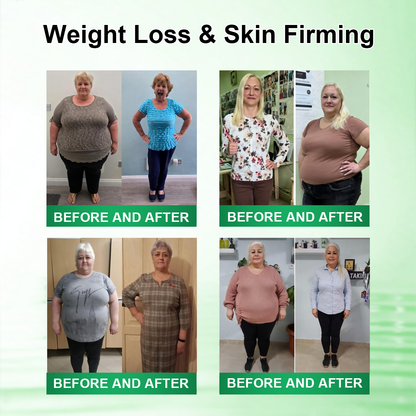 𝑶𝒇𝒇𝒊𝒄𝒊𝒂𝒍 𝑺𝒕𝒐𝒓𝒆 |🍀🍀𝐂𝐚𝐫𝐞𝐔𝐩𝐥𝐢𝐟𝐭® 𝑴𝒆𝒕𝒂𝒃𝒐𝒍𝒊𝒄 𝑵𝒂𝒏𝒐 𝑴𝒊𝒄𝒓𝒐𝒏𝒆𝒆𝒅𝒍𝒆 𝑷𝒂𝒕𝒄𝒉🇺🇸(𝐉𝐮𝐬𝐭 𝐨𝐧𝐜𝐞 𝐚 𝐝𝐚𝐲）𝘽𝙚𝙧𝙗𝙚𝙧𝙞𝙣𝙚 + 𝙈𝙤𝙧𝙞𝙣𝙜𝙖 𝙁𝙤𝙧𝙢𝙪𝙡𝙖 ✅𝐨𝐛𝐞𝐬𝐢𝐭𝐲,𝐅𝐨𝐫 𝗟𝗼𝗼𝘀𝗲 𝘀𝗸𝗶𝗻,  𝐝𝐢𝐚𝐛𝐞𝐭𝐞𝐬, 𝐬𝐥𝐞𝐞𝐩 𝐚𝐩𝐧𝐞𝐚, 𝐣𝐨𝐢𝐧𝐭 𝐢𝐬𝐬𝐮𝐞𝐬, 𝐚𝐧𝐝 𝐦𝐨𝐫𝐞💯