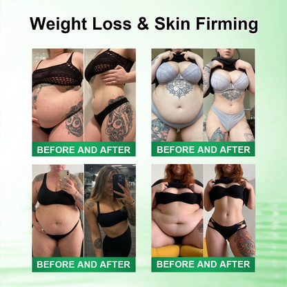 𝑶𝒇𝒇𝒊𝒄𝒊𝒂𝒍 𝑺𝒕𝒐𝒓𝒆 |🍀🍀𝐂𝐚𝐫𝐞𝐔𝐩𝐥𝐢𝐟𝐭® 𝑴𝒆𝒕𝒂𝒃𝒐𝒍𝒊𝒄 𝑵𝒂𝒏𝒐 𝑴𝒊𝒄𝒓𝒐𝒏𝒆𝒆𝒅𝒍𝒆 𝑷𝒂𝒕𝒄𝒉🇺🇸(𝐉𝐮𝐬𝐭 𝐨𝐧𝐜𝐞 𝐚 𝐝𝐚𝐲）𝘽𝙚𝙧𝙗𝙚𝙧𝙞𝙣𝙚 + 𝙈𝙤𝙧𝙞𝙣𝙜𝙖 𝙁𝙤𝙧𝙢𝙪𝙡𝙖 ✅𝐨𝐛𝐞𝐬𝐢𝐭𝐲,𝐅𝐨𝐫 𝗟𝗼𝗼𝘀𝗲 𝘀𝗸𝗶𝗻,  𝐝𝐢𝐚𝐛𝐞𝐭𝐞𝐬, 𝐬𝐥𝐞𝐞𝐩 𝐚𝐩𝐧𝐞𝐚, 𝐣𝐨𝐢𝐧𝐭 𝐢𝐬𝐬𝐮𝐞𝐬, 𝐚𝐧𝐝 𝐦𝐨𝐫𝐞💯